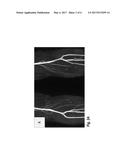 Interleaved Dual-Contrast Unenhanced Magnetic Resonance Angiography diagram and image