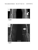 Interleaved Dual-Contrast Unenhanced Magnetic Resonance Angiography diagram and image