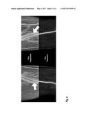 Interleaved Dual-Contrast Unenhanced Magnetic Resonance Angiography diagram and image