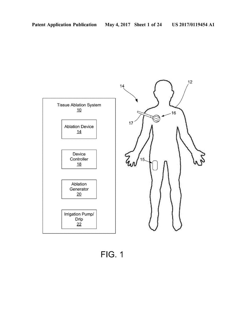 SCREEN SPHERE TISSUE ABLATION DEVICES AND METHODS - diagram, schematic, and image 02