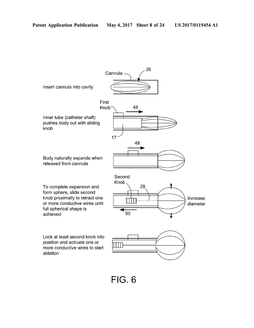 SCREEN SPHERE TISSUE ABLATION DEVICES AND METHODS - diagram, schematic, and image 09