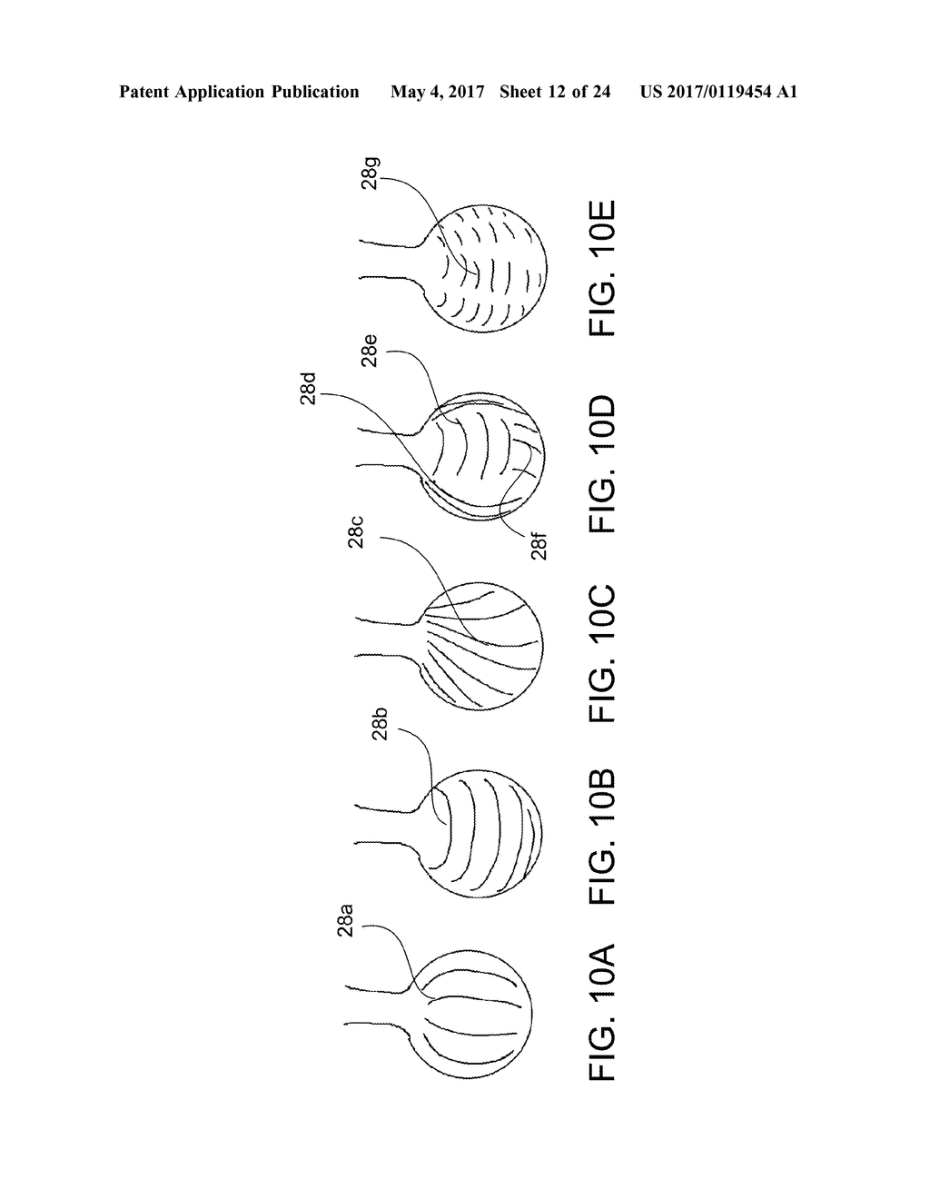 SCREEN SPHERE TISSUE ABLATION DEVICES AND METHODS - diagram, schematic, and image 13