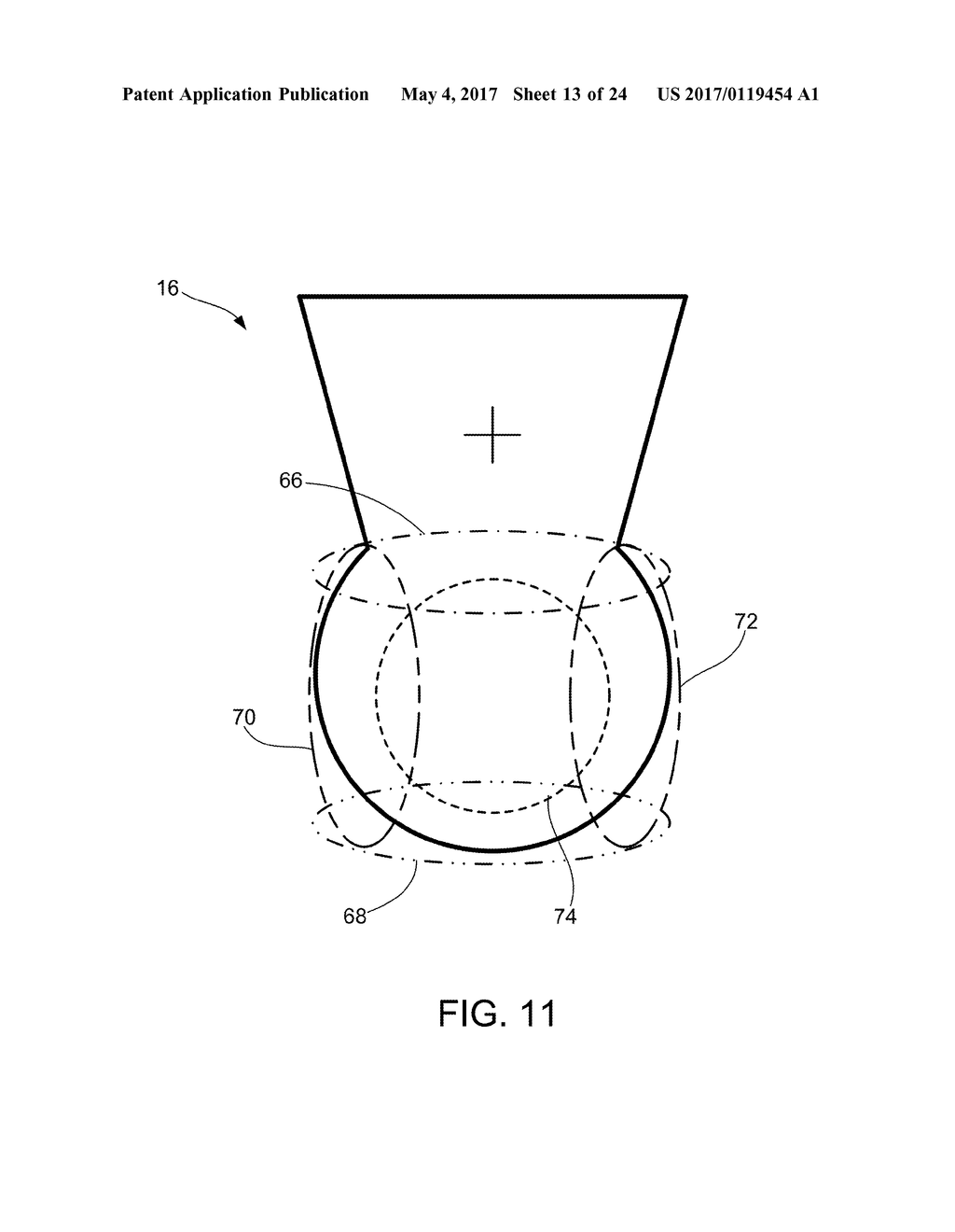 SCREEN SPHERE TISSUE ABLATION DEVICES AND METHODS - diagram, schematic, and image 14