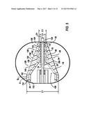 Stent Delivery Catheter diagram and image