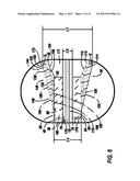 Stent Delivery Catheter diagram and image