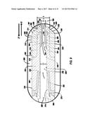 Stent Delivery Catheter diagram and image