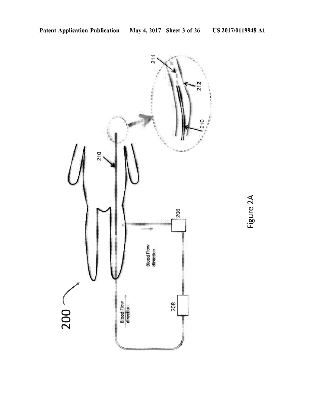 SYSTEMS AND METHODS FOR PROVIDING ZONES OF SELECTIVE THERMAL THERAPY - diagram, schematic, and image 04