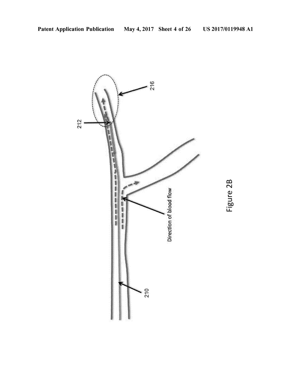 SYSTEMS AND METHODS FOR PROVIDING ZONES OF SELECTIVE THERMAL THERAPY - diagram, schematic, and image 05