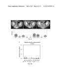 Molecular Analysis of Tumor Samples diagram and image