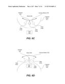 STABILIZING IMAGE SEQUENCES BASED ON CAMERA ROTATION AND FOCAL LENGTH     PARAMETERS diagram and image