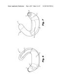 UNIVERSAL EARPIECE diagram and image