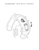 UNIVERSAL EARPIECE diagram and image