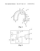 HEARING ASSISTANCE DEVICE AND METHOD OF FORMING SAME diagram and image