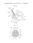 STENT FOR MEDICAL USE diagram and image