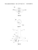 Fork-Type Covered Stent diagram and image