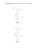 Fork-Type Covered Stent diagram and image