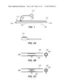 Bypass Configuration and Method of Construction diagram and image