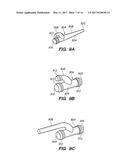 Bypass Configuration and Method of Construction diagram and image