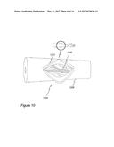 Bypass Configuration and Method of Construction diagram and image