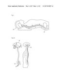 FUNCTIONAL PILLOW FOR MANIPULATION THERAPY diagram and image