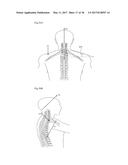 FUNCTIONAL PILLOW FOR MANIPULATION THERAPY diagram and image