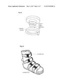 Traction Operating Table for Lower Limb Joint Surgery diagram and image