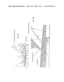 INTRADURAL ENDOSCOPE diagram and image