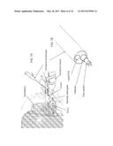 INTRADURAL ENDOSCOPE diagram and image