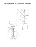 INTRADURAL ENDOSCOPE diagram and image