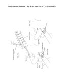 INTRADURAL ENDOSCOPE diagram and image