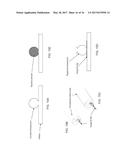 INTRADURAL ENDOSCOPE diagram and image