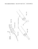 INTRADURAL ENDOSCOPE diagram and image