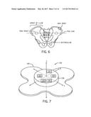 PATIENT POSITIONING SYSTEMS AND METHODS diagram and image