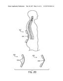 PATIENT POSITIONING SYSTEMS AND METHODS diagram and image