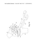 FEMORAL SYSTEM HANDLE SURGICAL INSTRUMENT AND METHOD OF ASSEMBLING SAME diagram and image