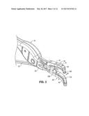 VESSEL SEALING FORCEPS diagram and image