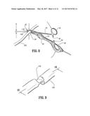 VESSEL SEALING FORCEPS diagram and image