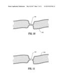 VESSEL SEALING FORCEPS diagram and image