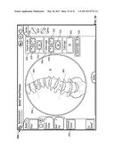 Systems and Methods for Planning, Performing, and Assessing Spinal     Correction During Surgery diagram and image