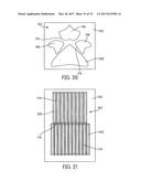 Endodontic Rotary Instruments Made From Hollow Tubes and Methods of     Manufacturing Thereof diagram and image