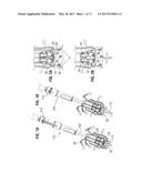 SAFETY SYSTEMS FOR EXPANSION OF PROSTHETIC HEART VALVES diagram and image