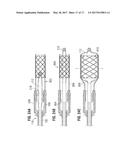 SAFETY SYSTEMS FOR EXPANSION OF PROSTHETIC HEART VALVES diagram and image