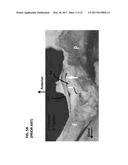 Femoral Heads, Mobile Inserts, Acetabular Components, and Modular     Junctions for Orthopedic Implants and Methods of Using Femoral Heads,     Mobile Insets, Acetabular Components, and Modular Junctions for     Orthopedic Implants diagram and image