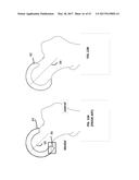 Femoral Heads, Mobile Inserts, Acetabular Components, and Modular     Junctions for Orthopedic Implants and Methods of Using Femoral Heads,     Mobile Insets, Acetabular Components, and Modular Junctions for     Orthopedic Implants diagram and image