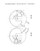 Femoral Heads, Mobile Inserts, Acetabular Components, and Modular     Junctions for Orthopedic Implants and Methods of Using Femoral Heads,     Mobile Insets, Acetabular Components, and Modular Junctions for     Orthopedic Implants diagram and image