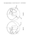 Femoral Heads, Mobile Inserts, Acetabular Components, and Modular     Junctions for Orthopedic Implants and Methods of Using Femoral Heads,     Mobile Insets, Acetabular Components, and Modular Junctions for     Orthopedic Implants diagram and image