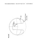 Femoral Heads, Mobile Inserts, Acetabular Components, and Modular     Junctions for Orthopedic Implants and Methods of Using Femoral Heads,     Mobile Insets, Acetabular Components, and Modular Junctions for     Orthopedic Implants diagram and image