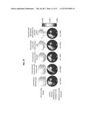 Femoral Heads, Mobile Inserts, Acetabular Components, and Modular     Junctions for Orthopedic Implants and Methods of Using Femoral Heads,     Mobile Insets, Acetabular Components, and Modular Junctions for     Orthopedic Implants diagram and image