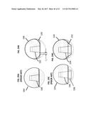 Femoral Heads, Mobile Inserts, Acetabular Components, and Modular     Junctions for Orthopedic Implants and Methods of Using Femoral Heads,     Mobile Insets, Acetabular Components, and Modular Junctions for     Orthopedic Implants diagram and image