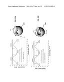 Femoral Heads, Mobile Inserts, Acetabular Components, and Modular     Junctions for Orthopedic Implants and Methods of Using Femoral Heads,     Mobile Insets, Acetabular Components, and Modular Junctions for     Orthopedic Implants diagram and image